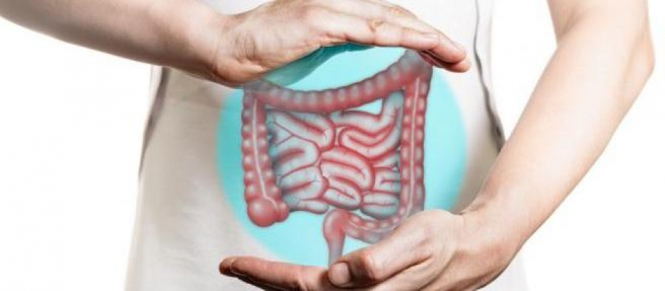 Cáncer de colon