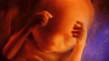24weekunbornbaby