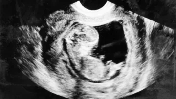 12weekunbornbaby3